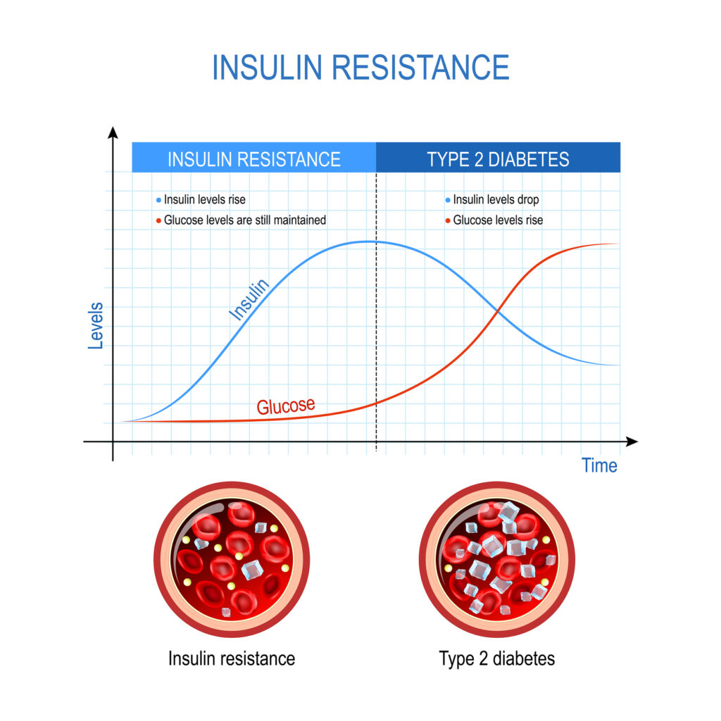 Insulin resistance progression